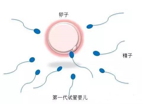 试管婴儿供卵代生咨询